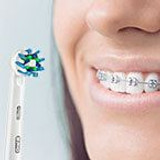 How to Brush Your Teeth and Floss With Braces