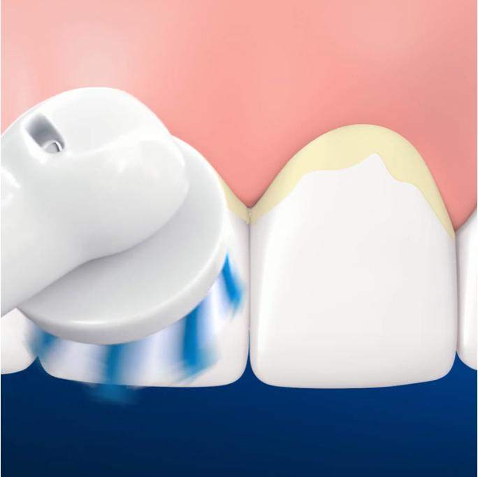 Post Purchase - Power of Brushing benefits on Gums